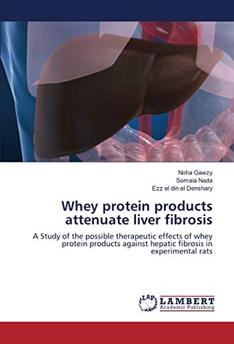 Whey protein products attenuate liver fibrosis: A Study of the possible therapeutic effects of whey protein products against hepatic fibrosis in experimental rats