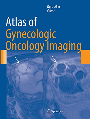 Atlas of Gynecologic Oncology Imaging (Atlas of Oncology Imaging)