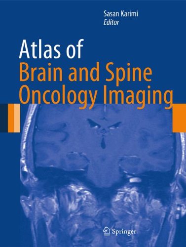 Atlas of Brain and Spine Oncology Imaging (Atlas of Oncology Imaging)