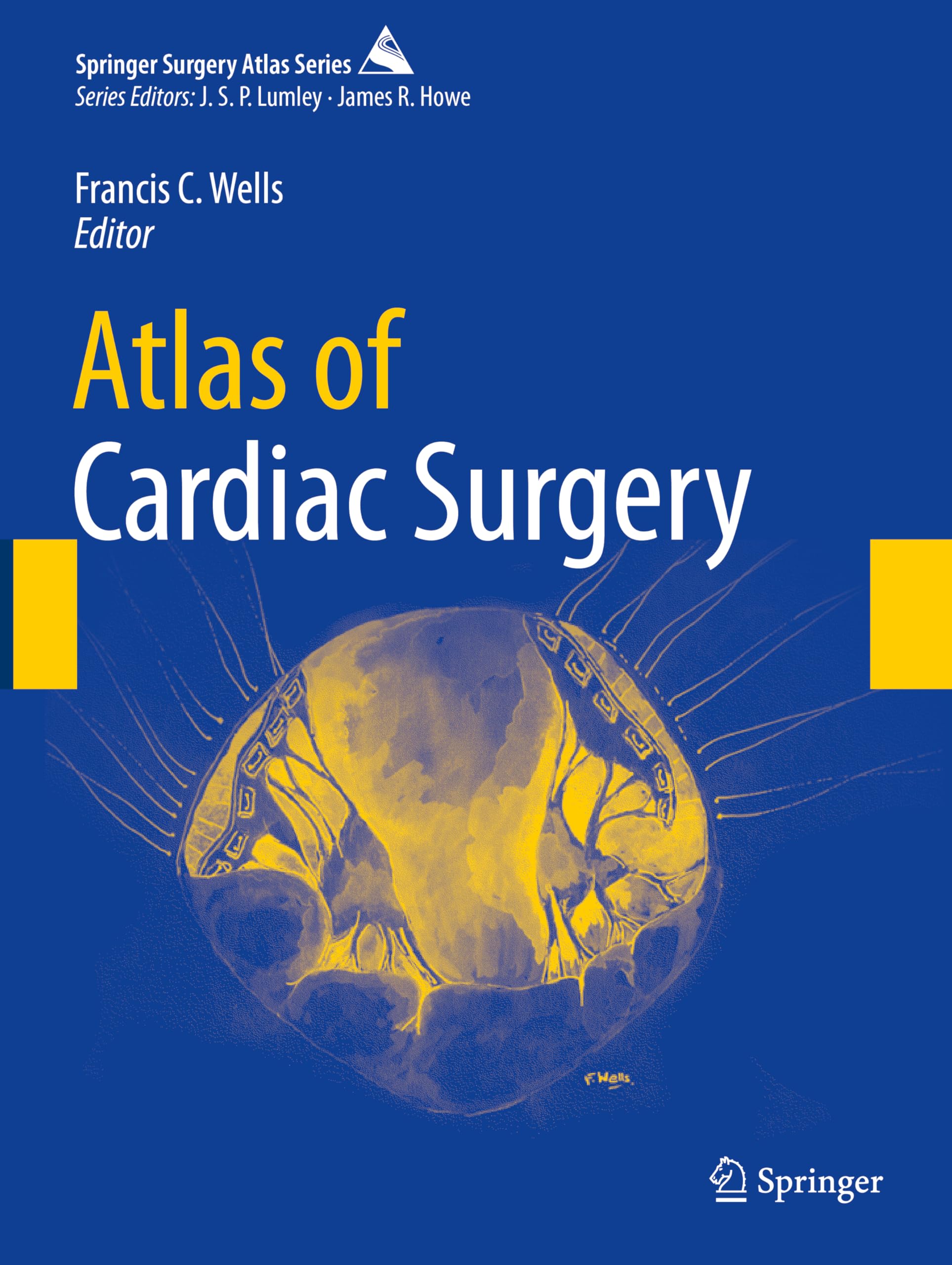 Atlas of Cardiac Surgery (Springer Surgery Atlas Series)