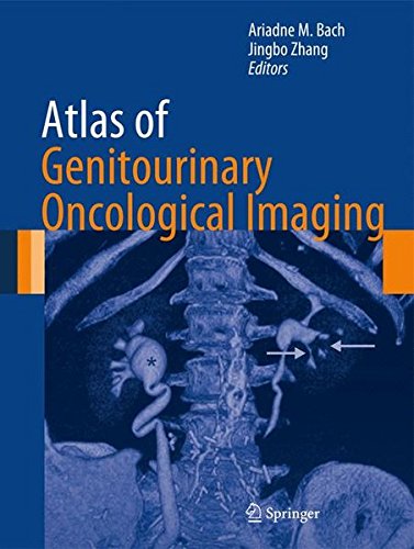 Atlas of Genitourinary Oncological Imaging (Atlas of Oncology Imaging)