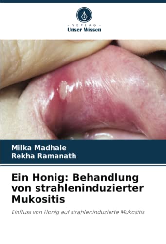 Ein Honig: Behandlung von strahleninduzierter Mukositis: Einfluss von Honig auf strahleninduzierte Mukositis
