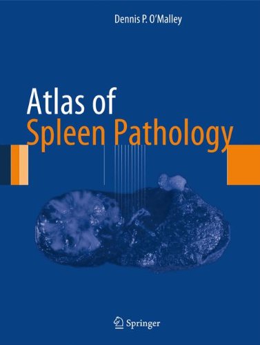 Atlas of Spleen Pathology (Atlas of Anatomic Pathology)