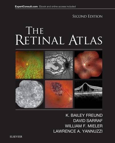 The Retinal Atlas: Expert Consult - Online and Print
