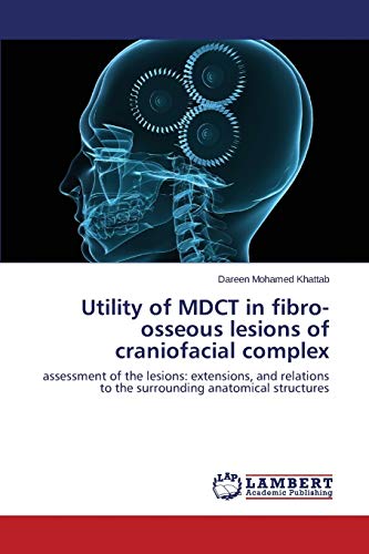 Utility of MDCT in fibro-osseous lesions of craniofacial complex: assessment of the lesions: extensions, and relations to the surrounding anatomical structures