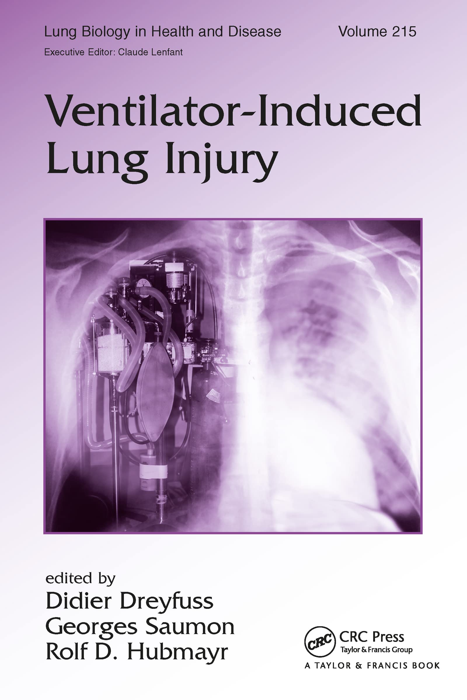 Ventilator-Induced Lung Injury (Lung Biology in Health and Disease, 215, Band 215)