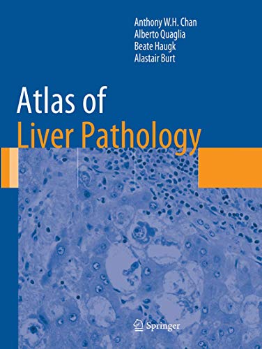 Atlas of Liver Pathology (Atlas of Anatomic Pathology)